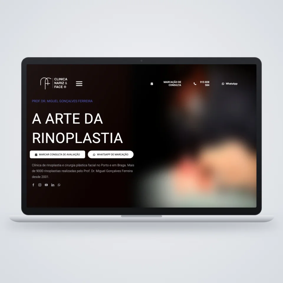 Site para clínica de rinoplastia da Clínica do Nariz e Face, Porto e Braga, num portátil
